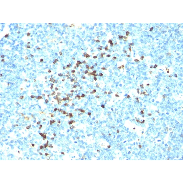 Immunohistochemistry - Anti-Human IgM Heavy Chain Antibody [DA4-4] (A252143) - Antibodies.com