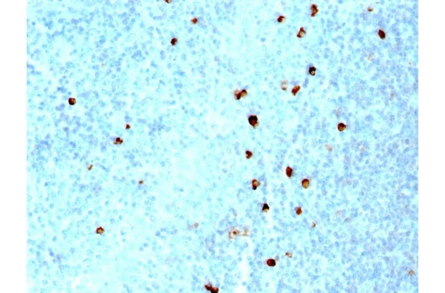 Immunohistochemistry - Anti-Human IgM Heavy Chain Antibody [SPM557] (A252138) - Antibodies.com