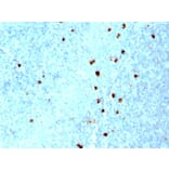 Immunohistochemistry - Anti-Human IgM Heavy Chain Antibody [SPM557] (A252138) - Antibodies.com