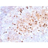 Immunohistochemistry - Anti-Human IgM Heavy Chain Antibody [IM373] (A248961) - Antibodies.com