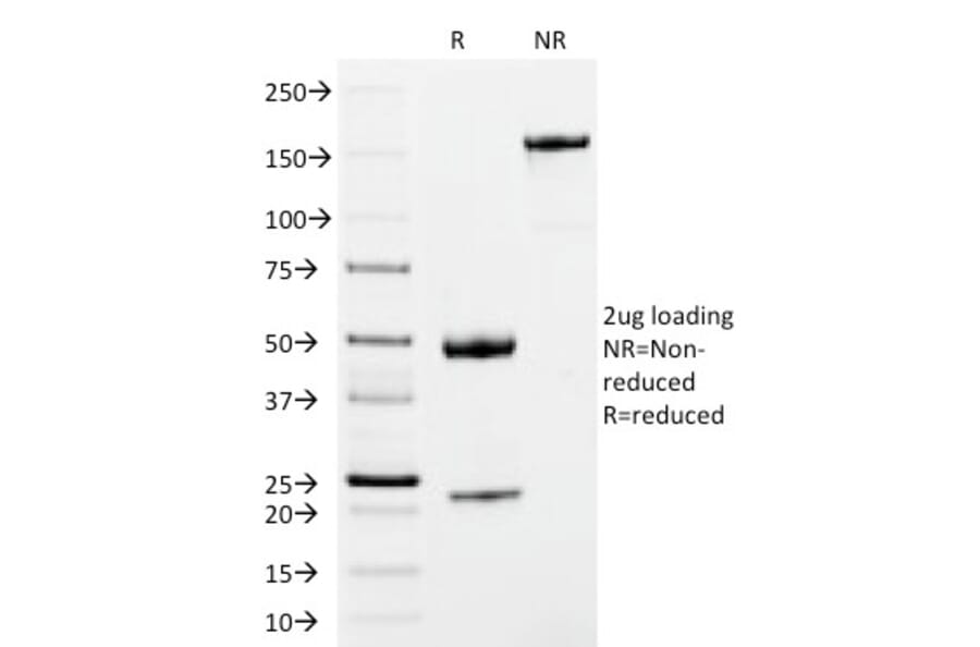 SDS-PAGE - Anti-Human IgM Heavy Chain Antibody [IM373] (A248962) - Antibodies.com