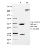 SDS-PAGE - Anti-Human IgM Heavy Chain Antibody [IM373] (A248962) - Antibodies.com