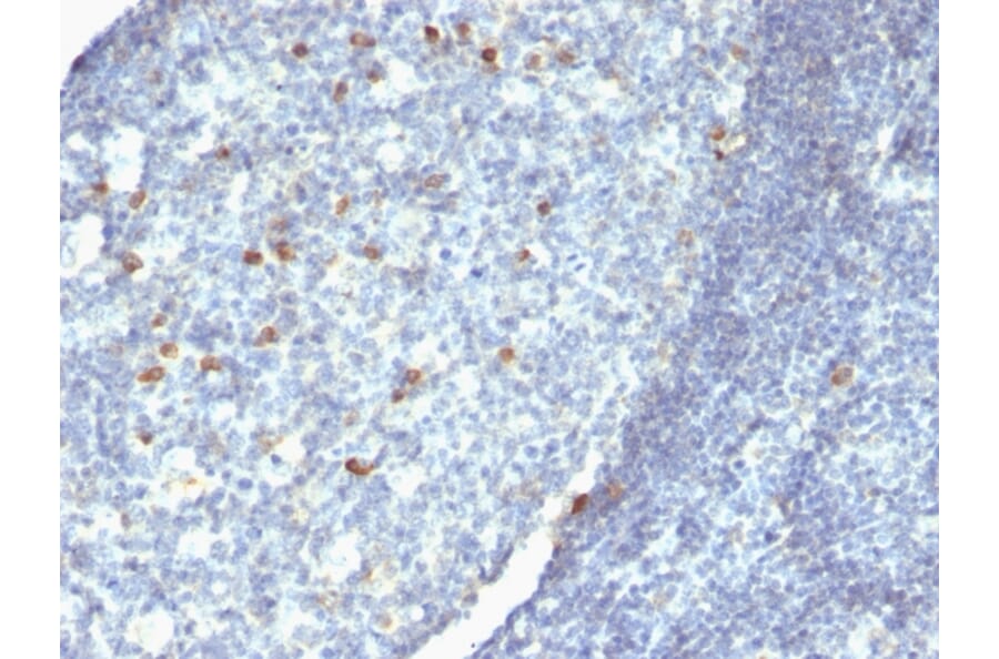 Immunohistochemistry - Anti-Human IgM Heavy Chain Antibody [Cocktail IgM] (A248962) - Antibodies.com