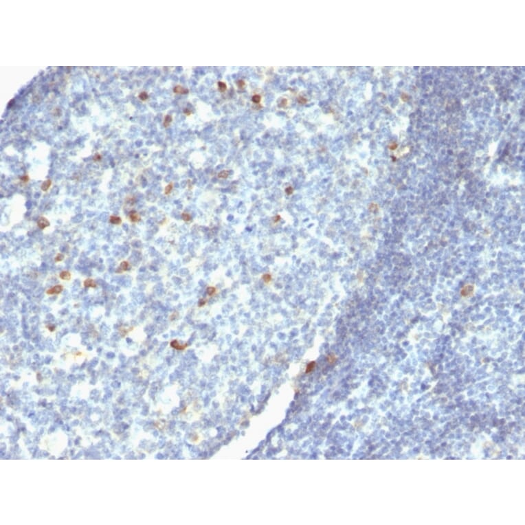 Immunohistochemistry - Anti-Human IgM Heavy Chain Antibody [Cocktail IgM] (A248962) - Antibodies.com