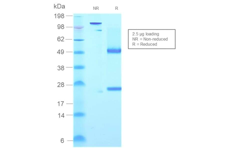SDS-PAGE - Anti-Human IgM Heavy Chain Antibody [rIGHM/2558] (A248966) - Antibodies.com