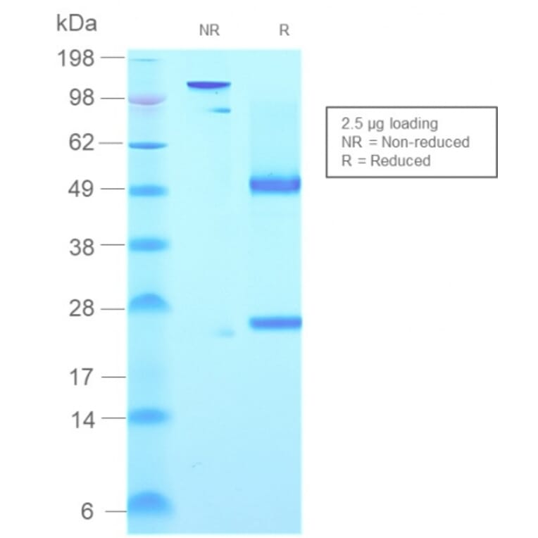SDS-PAGE - Anti-Human IgM Heavy Chain Antibody [rIGHM/2558] (A248966) - Antibodies.com
