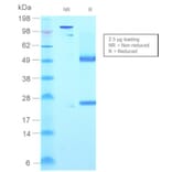 SDS-PAGE - Anti-Human IgM Heavy Chain Antibody [rIGHM/2558] (A248966) - Antibodies.com