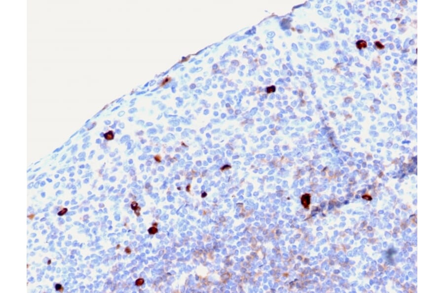 Immunohistochemistry - Anti-Human IgM Heavy Chain Antibody [rIGHM/2558] (A248965) - Antibodies.com