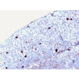 Immunohistochemistry - Anti-Human IgM Heavy Chain Antibody [rIGHM/2558] (A248965) - Antibodies.com