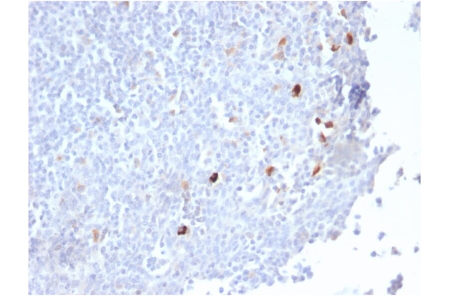 Immunohistochemistry - Anti-Human IgM Heavy Chain Antibody [IGHM/2559R] (A248966) - Antibodies.com