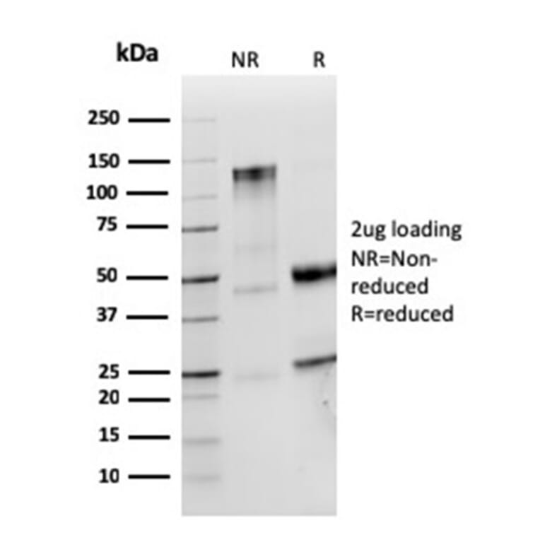 SDS-PAGE - Anti-Human IgM Heavy Chain Antibody [IGHM/2559R] (A248967) - Antibodies.com