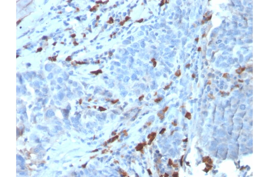 Immunohistochemistry - Anti-Human IgM Heavy Chain Antibody [IGHM/3135R] (A248967) - Antibodies.com