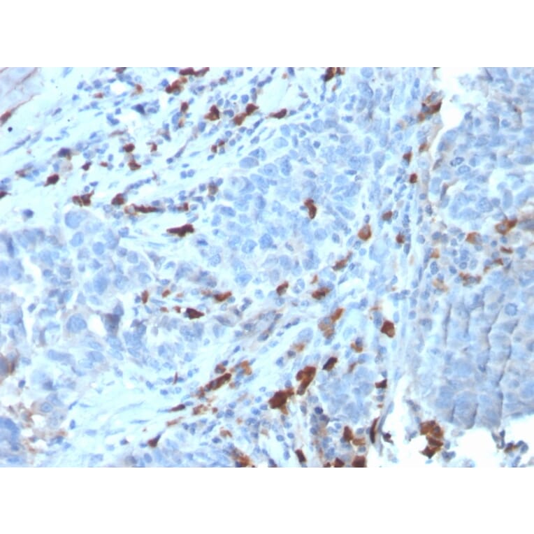 Immunohistochemistry - Anti-Human IgM Heavy Chain Antibody [IGHM/3135R] (A248967) - Antibodies.com