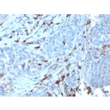 Immunohistochemistry - Anti-Human IgM Heavy Chain Antibody [IGHM/3135R] (A248967) - Antibodies.com