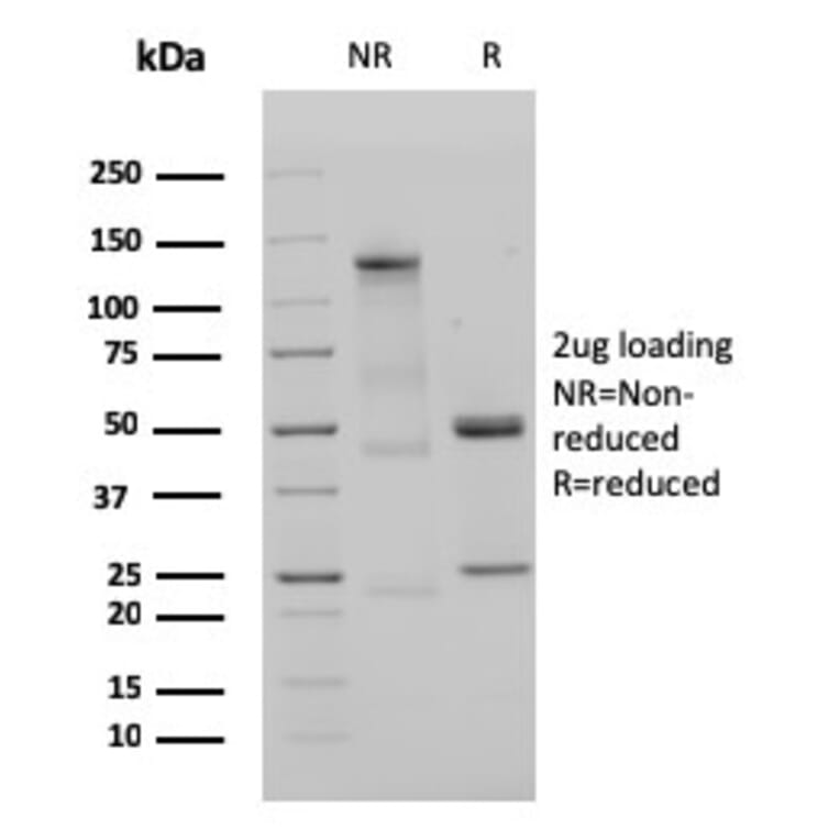 SDS-PAGE - Anti-Human IgM Heavy Chain Antibody [IGHM/3135R] (A248968) - Antibodies.com