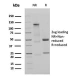 SDS-PAGE - Anti-Human IgM Heavy Chain Antibody [IGHM/3135R] (A248968) - Antibodies.com