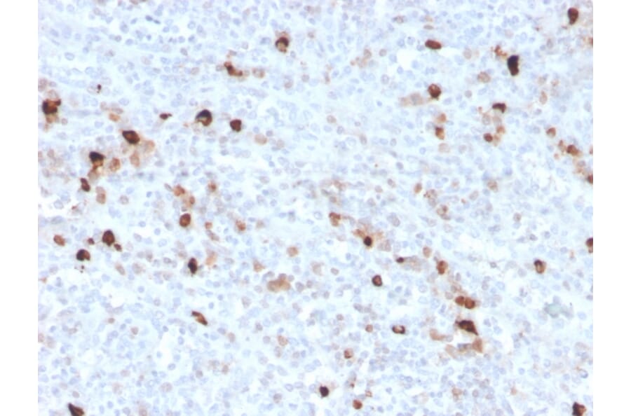 Immunohistochemistry - Anti-Human IgM Heavy Chain Antibody [IGHM/3776R] (A248969) - Antibodies.com