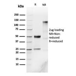 SDS-PAGE - Anti-Human IgM Heavy Chain Antibody [IGHM/3776R] (A248969) - Antibodies.com