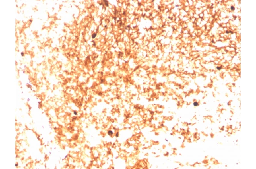 Immunohistochemistry - Anti-Human IgM Heavy Chain Antibody [IGHM/3803R] (A248969) - Antibodies.com