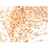 Immunohistochemistry - Anti-Human IgM Heavy Chain Antibody [IGHM/3803R] (A248969) - Antibodies.com