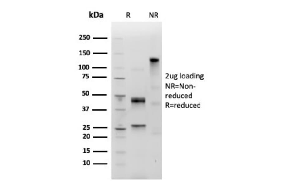 SDS-PAGE - Anti-Human IgM Heavy Chain Antibody [IGHM/3803R] (A248970) - Antibodies.com