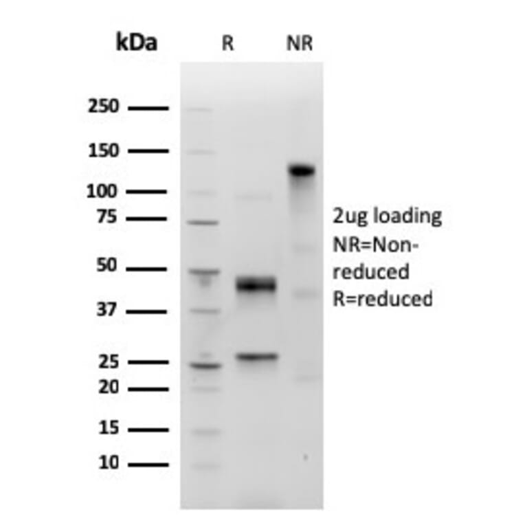 SDS-PAGE - Anti-Human IgM Heavy Chain Antibody [IGHM/3803R] (A248970) - Antibodies.com