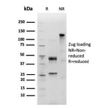 SDS-PAGE - Anti-Human IgM Heavy Chain Antibody [IGHM/3803R] (A248970) - Antibodies.com