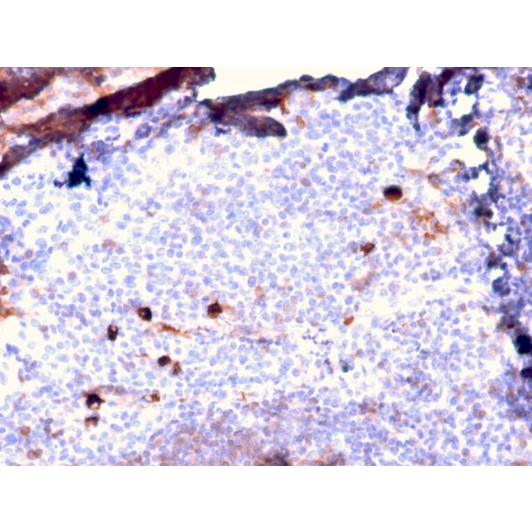 Immunohistochemistry - Anti-Human IgM Heavy Chain Antibody [IGHM/2557R] (A248971) - Antibodies.com