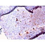 Immunohistochemistry - Anti-Human IgM Heavy Chain Antibody [IGHM/2557R] (A248970) - Antibodies.com