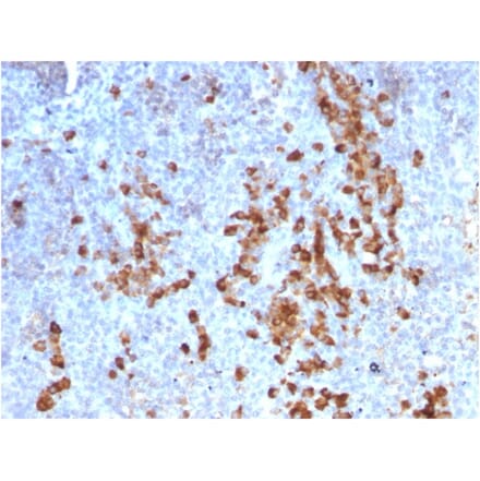 Immunohistochemistry - Anti-Kappa Light Chain Antibody [rKLC709] (A248972) - Antibodies.com