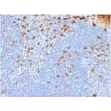 Immunohistochemistry - Anti-Kappa Light Chain Antibody [rL1C1] (A248974) - Antibodies.com