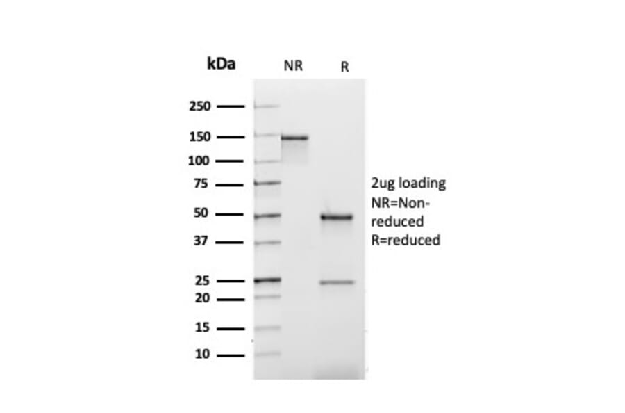 SDS-PAGE - Anti-Kappa Light Chain Antibody [rL1C1] (A248974) - Antibodies.com