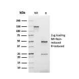 SDS-PAGE - Anti-Kappa Light Chain Antibody [rL1C1] (A248974) - Antibodies.com