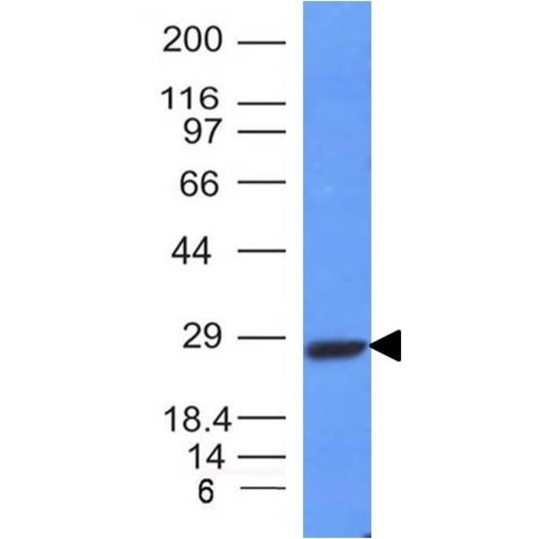 knecht Verhandeling fax Anti-Kappa Light Chain Antibody [L1C1] (A248975) | Antibodies.com
