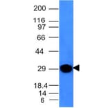 Western Blot - Anti-Kappa Light Chain Antibody [KLC264] (A248977) - Antibodies.com