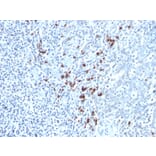 Immunohistochemistry - Anti-Kappa Light Chain Antibody [KLC264] (A248977) - Antibodies.com