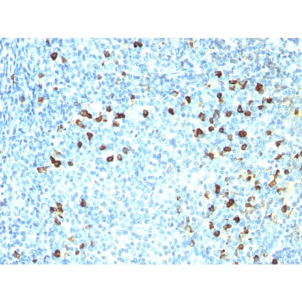 Immunohistochemistry - Anti-Kappa Light Chain Antibody [SPM558] (A248977) - Antibodies.com
