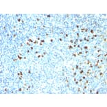 Immunohistochemistry - Anti-Kappa Light Chain Antibody [SPM558] (A248977) - Antibodies.com