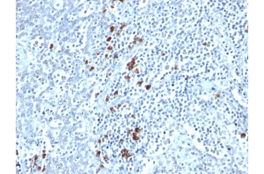 Immunohistochemistry - Anti-Kappa Light Chain Antibody [TB28-2] (A248978) - Antibodies.com