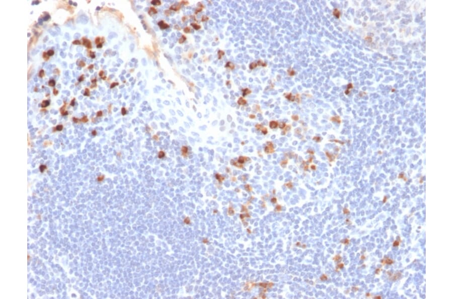 Immunohistochemistry - Anti-Kappa Light Chain Antibody [HP6053] (A248979) - Antibodies.com