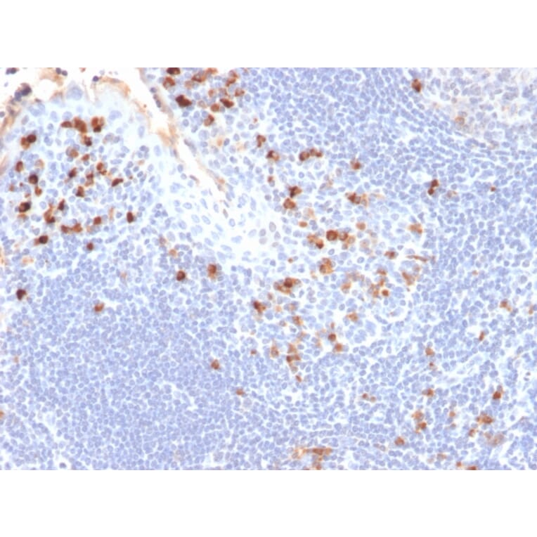 Immunohistochemistry - Anti-Kappa Light Chain Antibody [HP6053] (A248979) - Antibodies.com