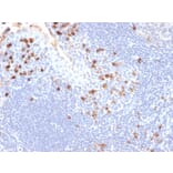Immunohistochemistry - Anti-Kappa Light Chain Antibody [HP6053] (A248979) - Antibodies.com