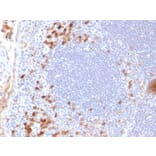 Immunohistochemistry - Anti-Kappa Light Chain Antibody [KLC709] (A248982) - Antibodies.com