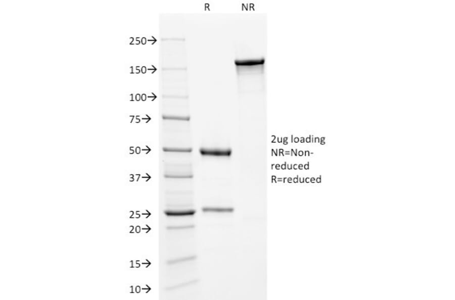 SDS-PAGE - Anti-Kappa Light Chain Antibody [KLC709] (A248982) - Antibodies.com