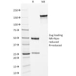 SDS-PAGE - Anti-Kappa Light Chain Antibody [KLC709] (A248982) - Antibodies.com