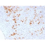 Immunohistochemistry - Anti-Kappa Light Chain Antibody [KLC1278] (A248983) - Antibodies.com