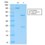 SDS-PAGE - Anti-Kappa Light Chain Antibody [KLC2289R] (A248985) - Antibodies.com