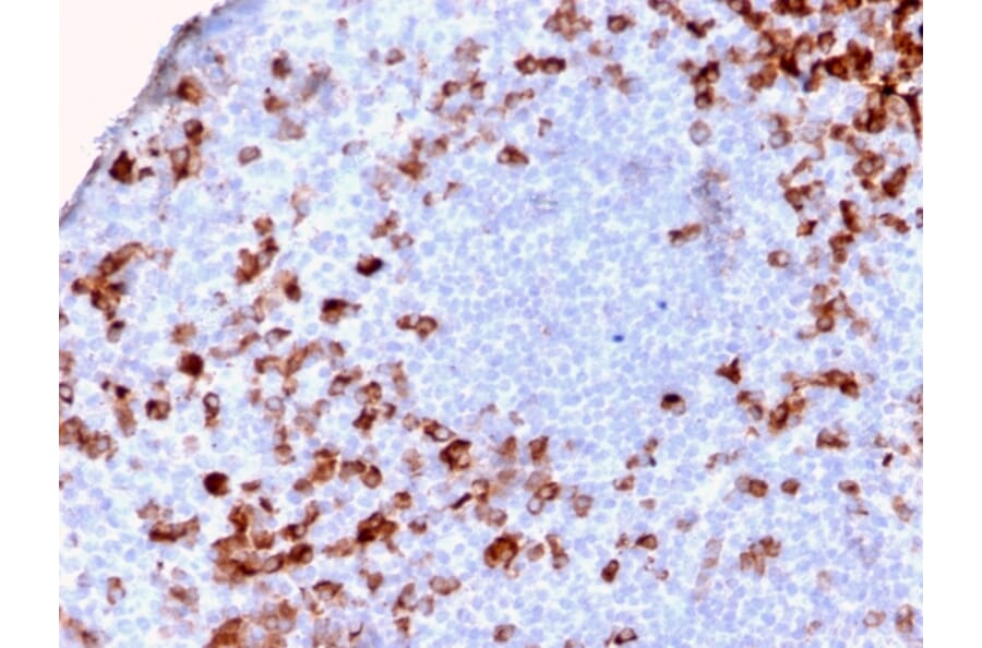 Immunohistochemistry - Anti-Kappa Light Chain Antibody [KLC2886R] (A248985) - Antibodies.com