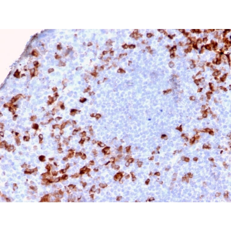 Immunohistochemistry - Anti-Kappa Light Chain Antibody [KLC2886R] (A248985) - Antibodies.com