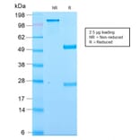 SDS-PAGE - Anti-Kappa Light Chain Antibody [KLC2886R] (A248986) - Antibodies.com
